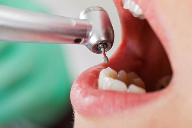 Tooth Infection Emergency Dentist in MI